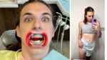 MrBeast's Chris Tyson's Dental Visit: Last Session For Achieving a Bright Smile at the Clinic!